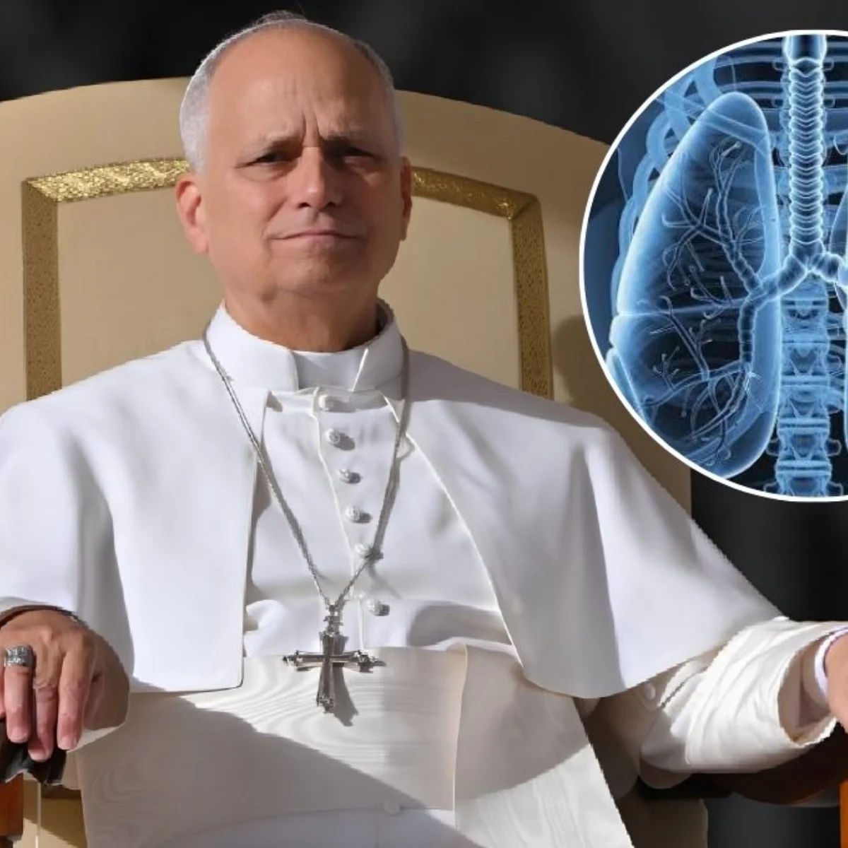 🕊️ Vaticano: El papa León XIV fue operado de urgencia tras detectarse un adenocarcinoma pulmonar